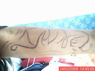 Kannel
